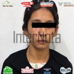 ALLENDE: DETIENEN A JOVEN DE 19 AÑOS POR PRESUNTOS R0B0S A CASA HABITACIÓN